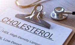 Cholesterol Management